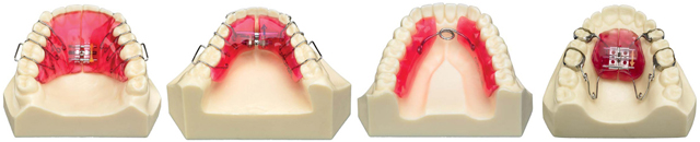 Ortopedia Dentofacial. Tratamiento de ortodoncia en Tetuán, Madrid
