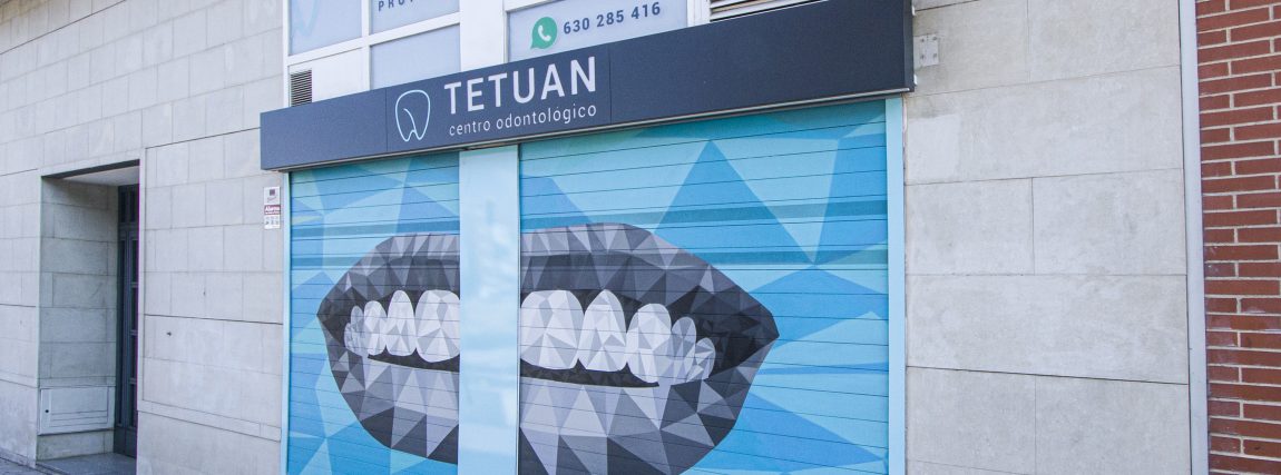 Centro odontológico Tetuán en Madrid. Tratamientos dentales